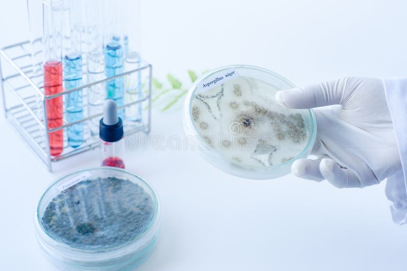 Scientist show colony of fungus & x28;Asperillus niger& x29; in culture medium plate, Microbiology. Scientist show colony of fungus & x28;Asperillus niger& x29; in culture medium plate, Microbiology.