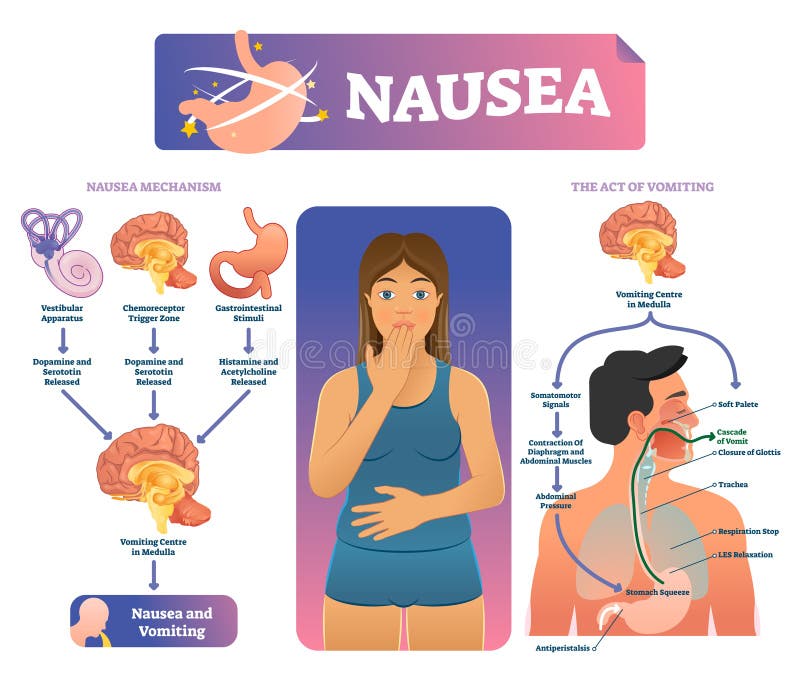 Nausea Stock Illustrations – 5,109 Nausea Stock Illustrations