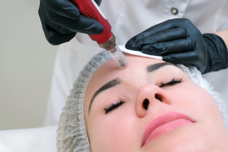 Needle Mesotherapy. Cosmetologist Performs Needle Mesotherapy on a Womans Face Stock Photo