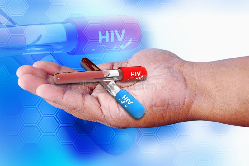 negativ positive för hiv arkivfoto negativ positive för hiv arkivfoto