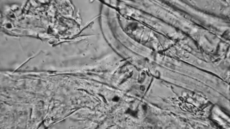 Nematodes and Worms in drinking Water under Microscope.