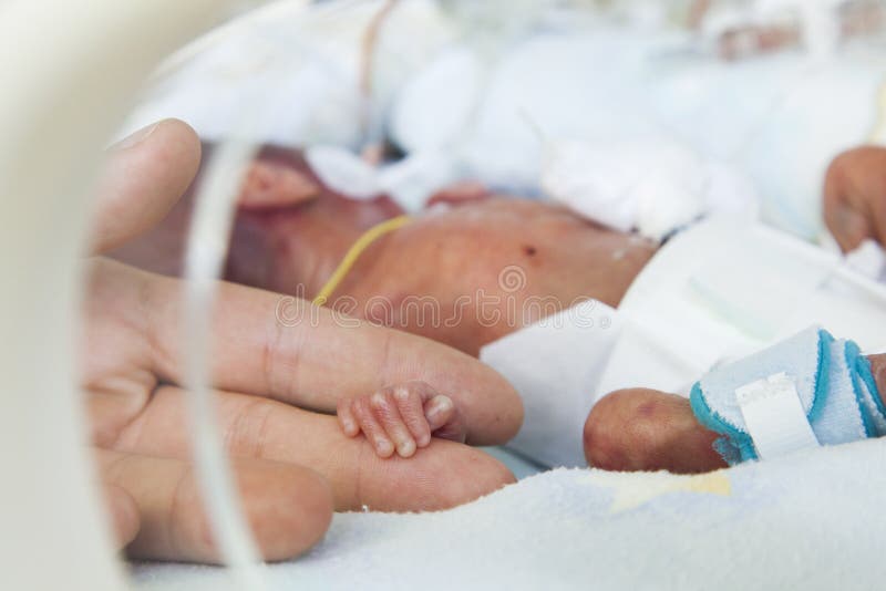 Neonatal intensivvård royaltyfri foto Neonatal intensivvård royaltyfri foto