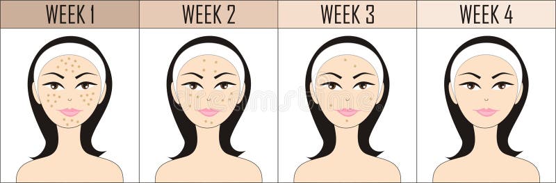 Nessun'acne Nessun'acne