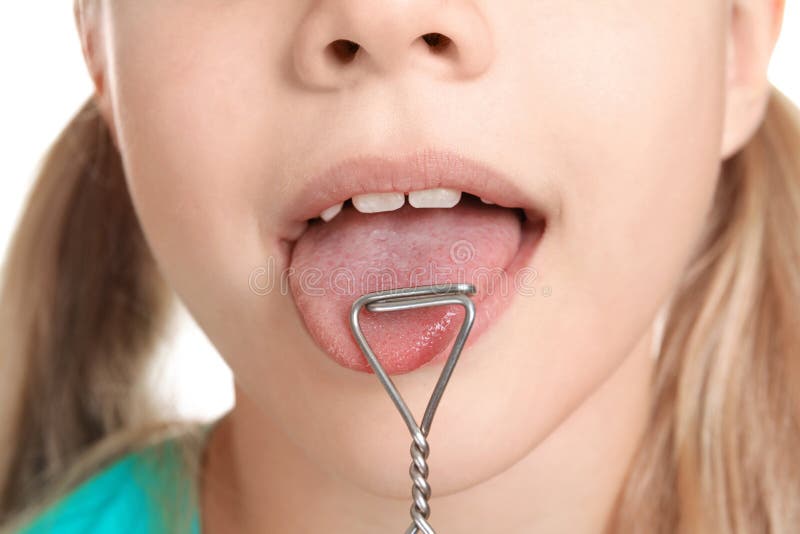 Nettes Mädchen mit logopedic Sonde für Sprachekorrektur, stockbilder Nettes Mädchen mit logopedic Sonde für Sprachekorrektur, stockbilder