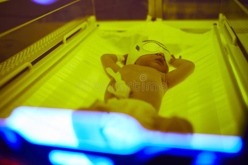 Neugeborenes Baby, das Phototherapie für Gelbsucht empfängt lizenzfreie stockfotos Neugeborenes Baby, das Phototherapie für Gelbsucht empfängt lizenzfreie stockfotos