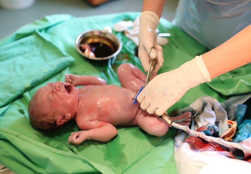 Neugeborenes Baby nach Geburt im Krankenhaus