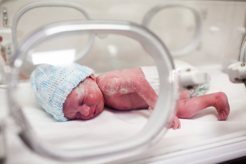 Neugeborenes Schätzchen abgedeckt im vertix im Inkubator