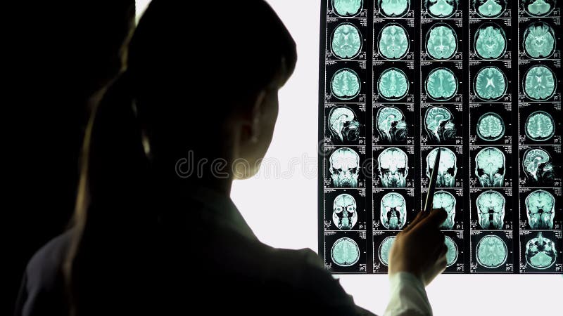 Neurosurgeon analyzing brain x-ray, blood vessels problems, incurable illness