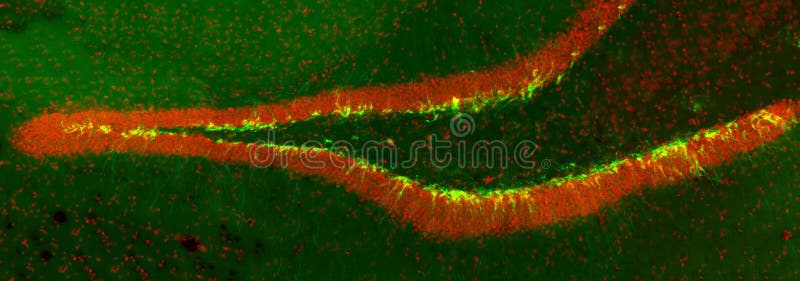 New born neurons in the transgenic mouse hippocampus (dentate gyrus) labeled with green fluorescent marker. New born neurons in the transgenic mouse hippocampus (dentate gyrus) labeled with green fluorescent marker