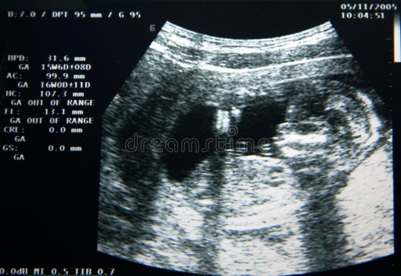 195 Baby Echo Photos Free Royalty Free Stock Photos From Dreamstime