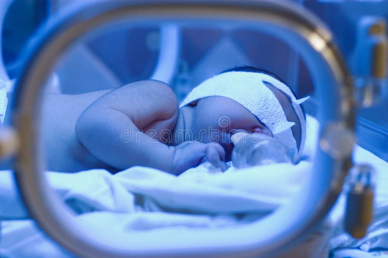 Newborn Baby Under Ultraviolet Light Stock Image Image of closeup