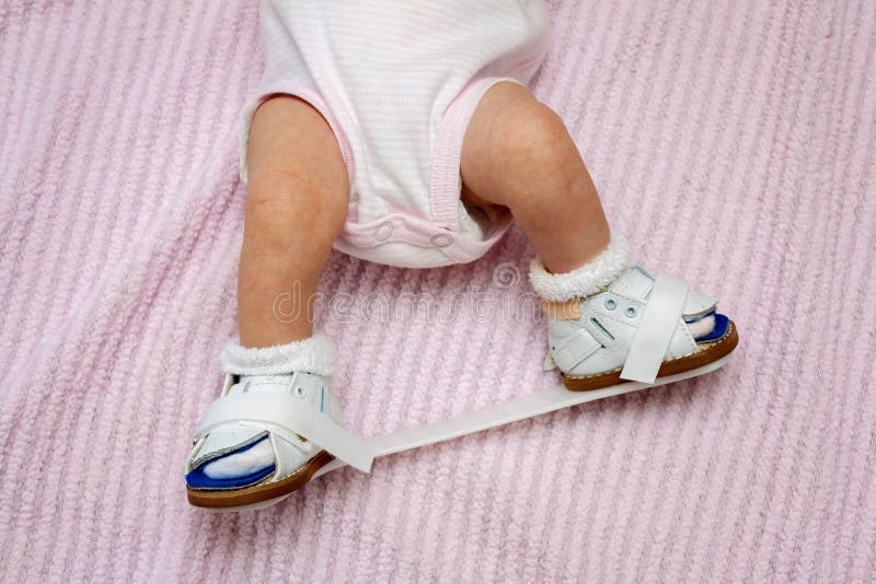 orthopedic shoes for baby boy