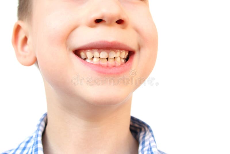 Niño Sonríe Con La Boca Cerrada Cerrando El Cierre De Un Concepto De Boca  De Niño Cuidado De La Piel De Niño Desarrollo Emocional Foto de archivo -  Imagen de oral, felicidad