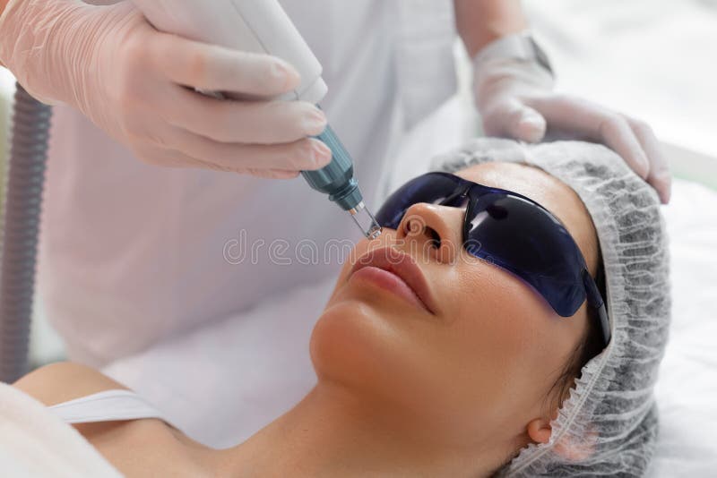 Nice pretty woman having a laser facial epilation royalty free stock photography Nice pretty woman having a laser facial epilation royalty free stock photography