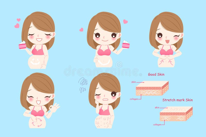 怀孕的女人，有妊娠纹 向量例证