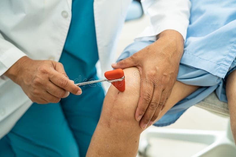 Ένας Ασιατικός γιατρός χρησιμοποιεί ένα σφυρί για να ελέγξει το αντανακλαστικό του γόνατος, τα νεύρα και τους μυς μιας ηλικιωμένης στοκ εικόνα με δικαίωμα ελεύθερης χρήσης