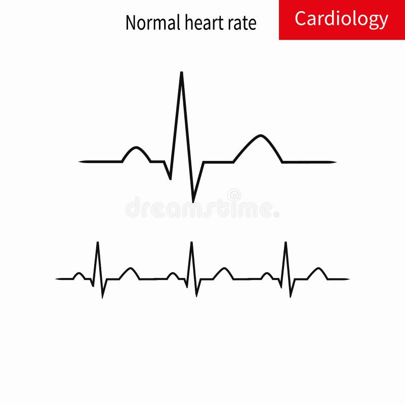 Normaal complex en normaal de sinusritme van ECG stock illustratie Normaal complex en normaal de sinusritme van ECG stock illustratie