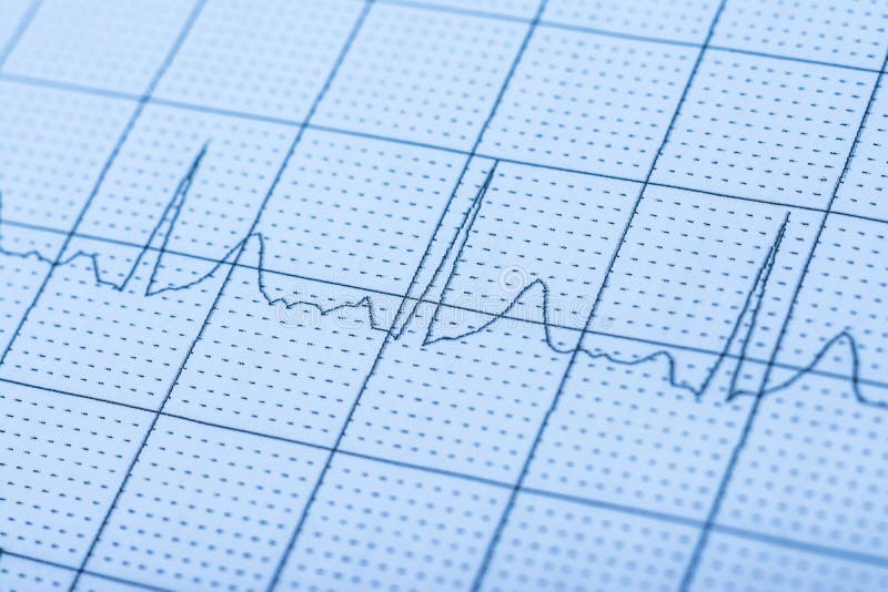 Normal Electrocardiogram Record On Paper