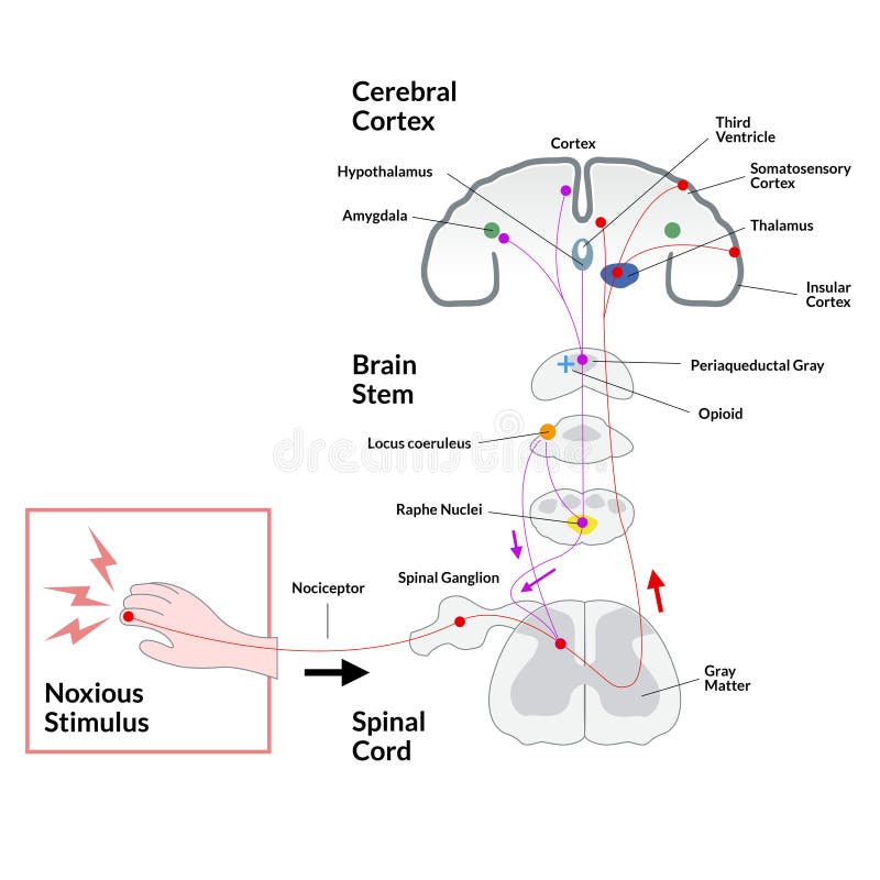 what is the presentation of noxious stimuli