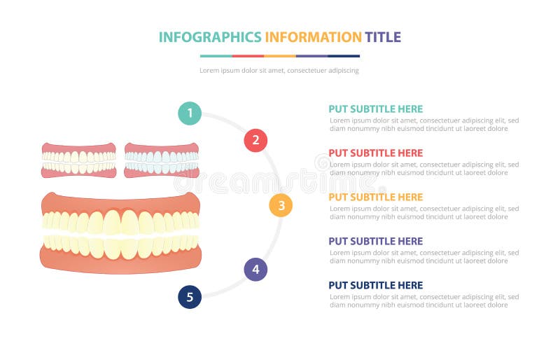 O dente humano ou o conceito infographic do molde dos dentes com cinco pontos alistam e v?ria cor com fundo branco moderno limpo ilustração do vetor O dente humano ou o conceito infographic do molde dos dentes com cinco pontos alistam e v?ria cor com fundo branco moderno limpo ilustração do vetor