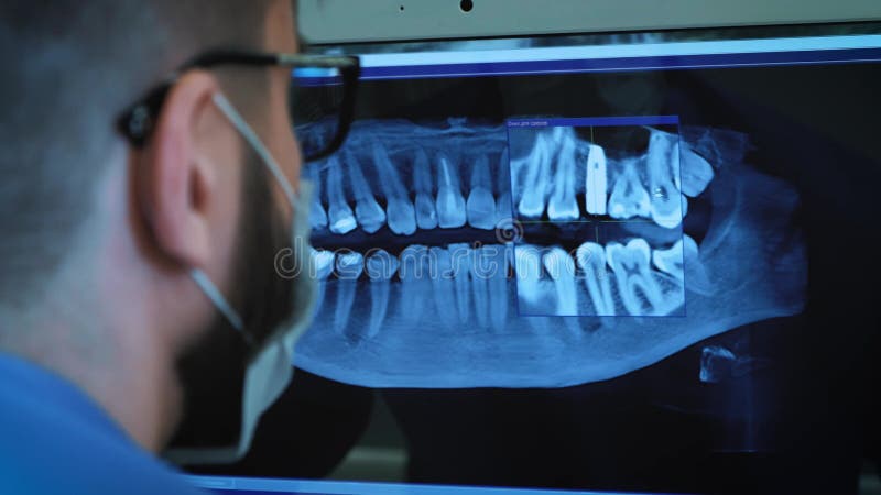 O dentista está estudando a imagem do raio X 3D da maxila