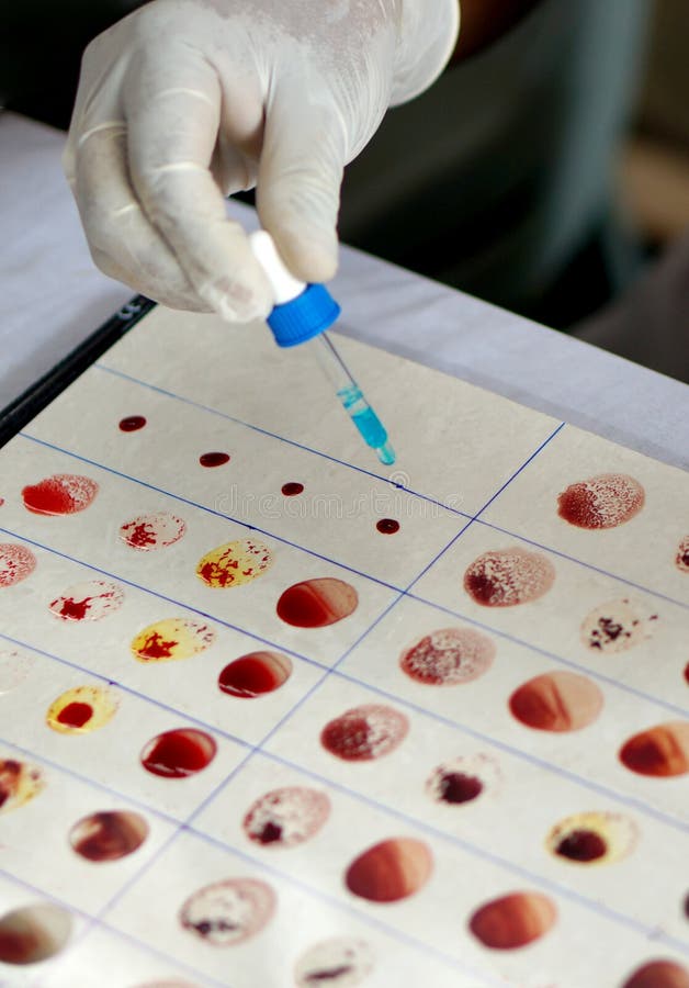 O doutor verifica o grupo sanguíneo do paciente ou do doador misturando a amostra de sangue de um paciente com o reagente fotos de stock royalty free O doutor verifica o grupo sanguíneo do paciente ou do doador misturando a amostra de sangue de um paciente com o reagente fotos de stock royalty free