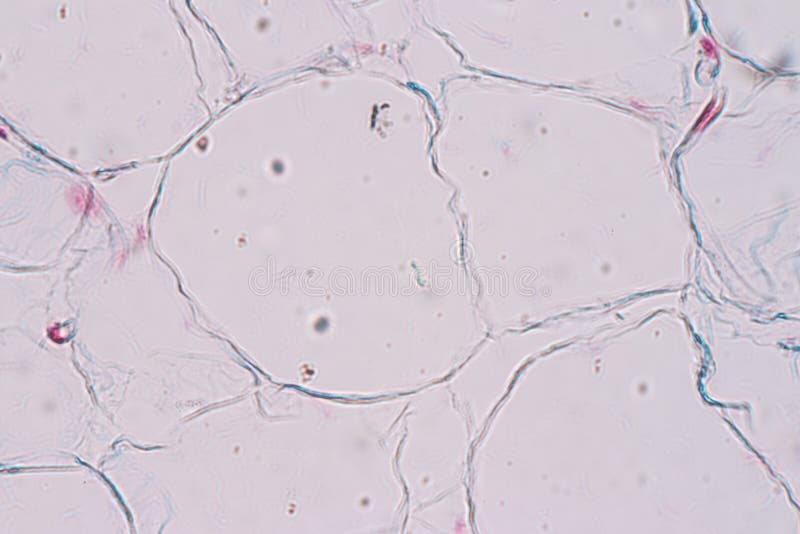 O Tecido Adiposo Gordura Corporal Simplesmente Gordura E Um Tecido Conjuntivo Fraco Sob O Microscopico Foto De Stock Imagem De Medico Patologia O Tecido Adiposo Gordura Corporal Simplesmente Gordura E Um Tecido Conjuntivo Fraco Sob O Microscopico Foto De Stock Imagem De Medico Patologia