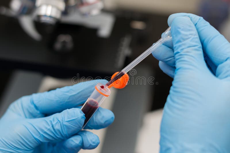 O veterinário que toma duas gotas de sangue com a pipeta de um tubo de coleta com heparina foto de stock royalty free O veterinário que toma duas gotas de sangue com a pipeta de um tubo de coleta com heparina foto de stock royalty free