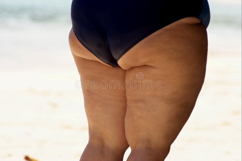 399 Obese Woman Cellulite Legs Stock Photos - Free & Royalty-Free Stock  Photos from Dreamstime