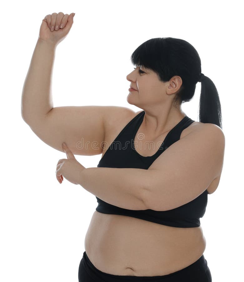 Obese Woman with Flabby Arm on White Background. Weight Loss Surgery Stock  Image - Image of appearance, plastic: 244384019