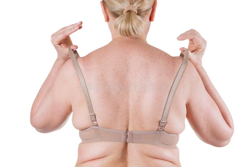 Obese Bra Back Stock Photos - Free & Royalty-Free Stock Photos from  Dreamstime