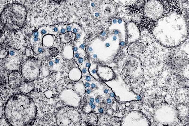 Obraz mikroskopu elektronowego transmisyjnego wirusa covid 19