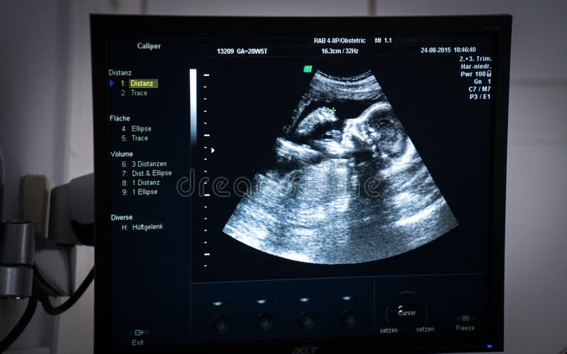 Obstetrisk ultraljud av fostret arkivfoto Obstetrisk ultraljud av fostret arkivfoto