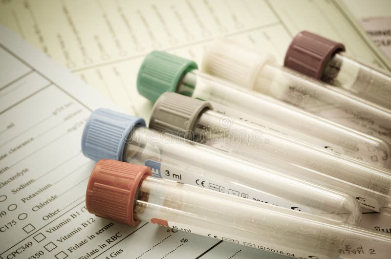 Blood Test Tubes Investigation Form Laboratory Stock Photos Free