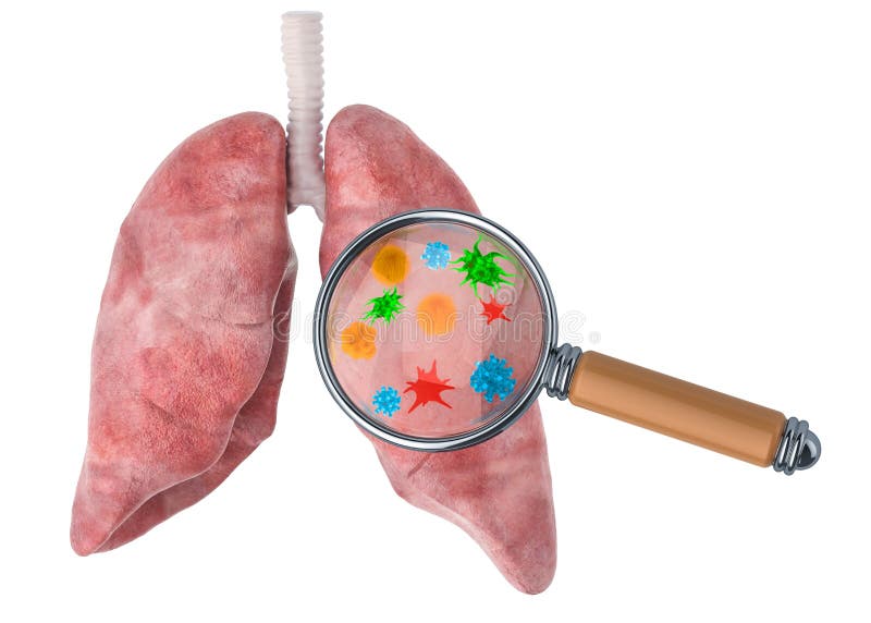 Onderzoek en diagnose van het concept van longenziekten Menselijke longen met virussen en bacterias onder vergrootglas, het 3D te vector illustratie Onderzoek en diagnose van het concept van longenziekten Menselijke longen met virussen en bacterias onder vergrootglas, het 3D te vector illustratie