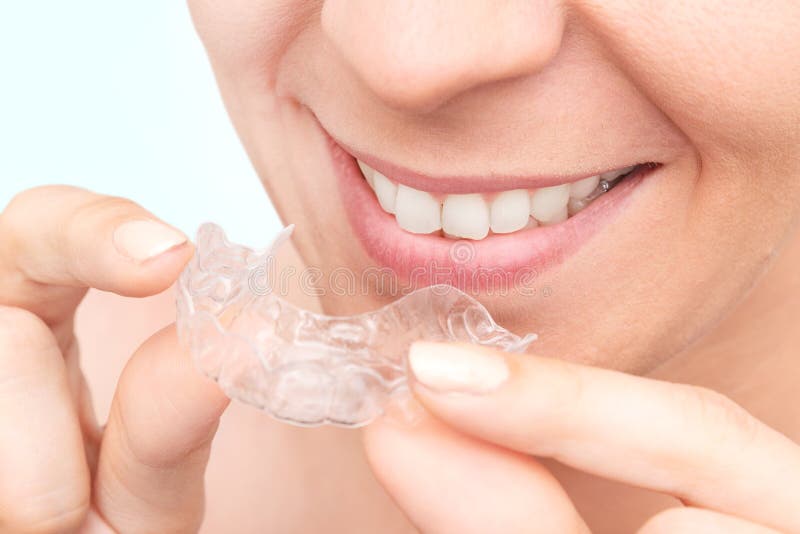 Onzichtbare orthodontie siliconenuitlijner royalty-vrije stock fotografie Onzichtbare orthodontie siliconenuitlijner royalty-vrije stock fotografie