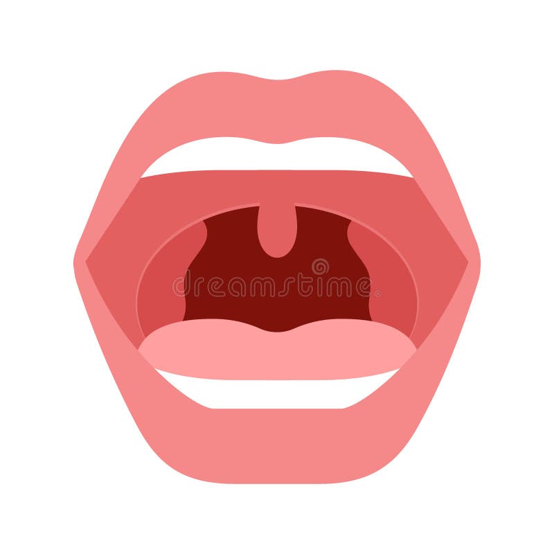 Open mouth with health and sick throat of human. Comparison healthy throat, tonsillitis bacterial and viral. Infection royalty free illustration