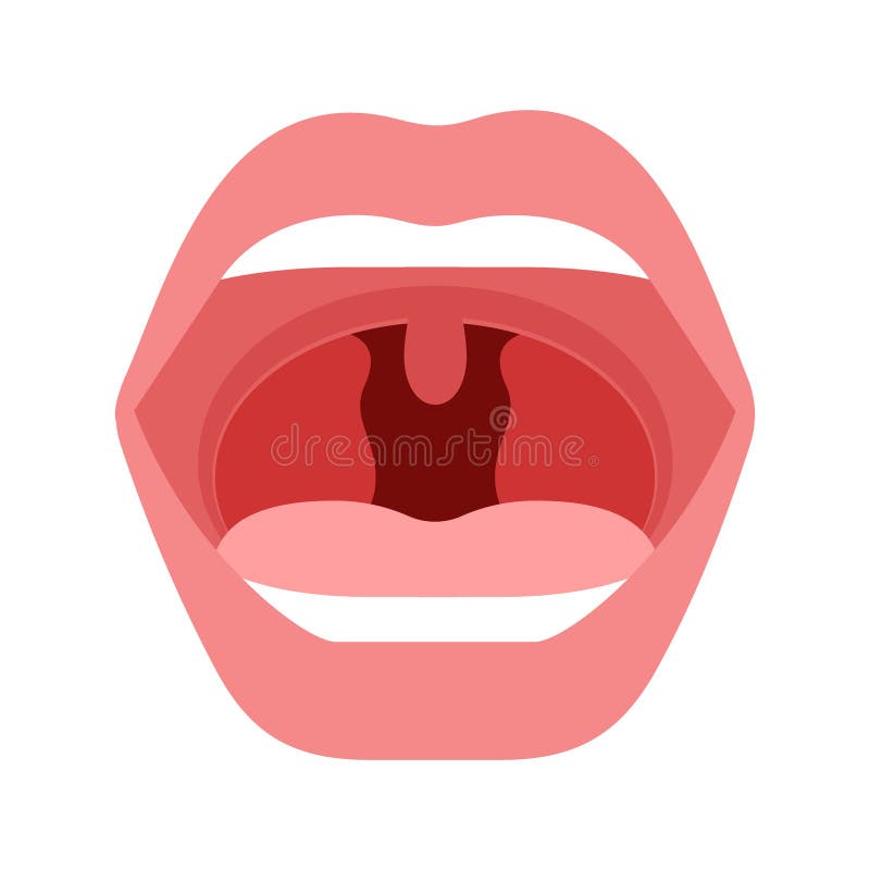 Open mouth with unhealth throat, tonsillitis of human. Infection, redness of tonsils. Inflammation airway, pain in royalty free illustration