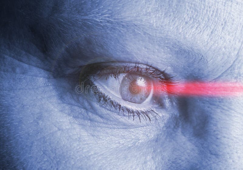 Operazione del laser dell'occhio fotografie stock Operazione del laser dell'occhio fotografie stock