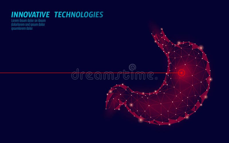Operação humana da cirurgia do laser do estômago baixo poli Área dolorosa do tratamento da droga da doença da medicina Triângulos ilustração do vetor Operação humana da cirurgia do laser do estômago baixo poli Área dolorosa do tratamento da droga da doença da medicina Triângulos ilustração do vetor