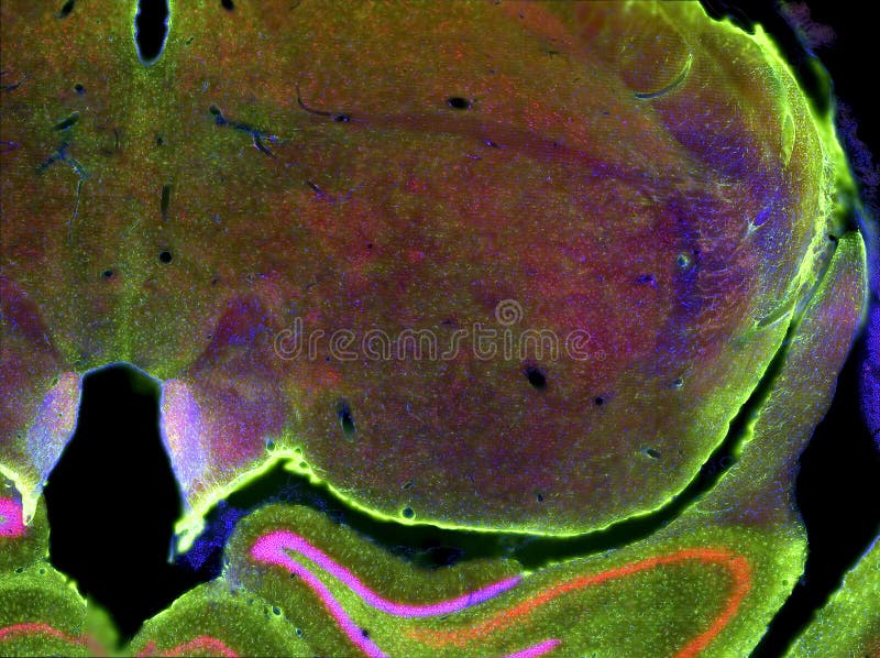 Fluorescence view of rat brain slice. Fluorescence view of rat brain slice