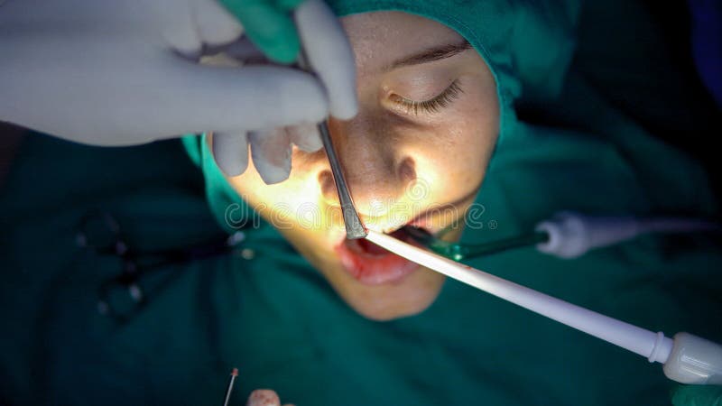 Oral surgery operation, in a dark operation room royalty free stock photography Oral surgery operation, in a dark operation room royalty free stock photography