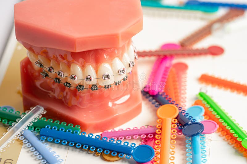 283 Braces Rubber Bands Stock Photos - Free & Royalty-Free Stock