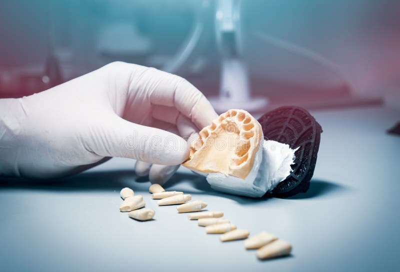 Orthodontic Prosthesis. Laboratory. Closeup. Dental. Stock Image