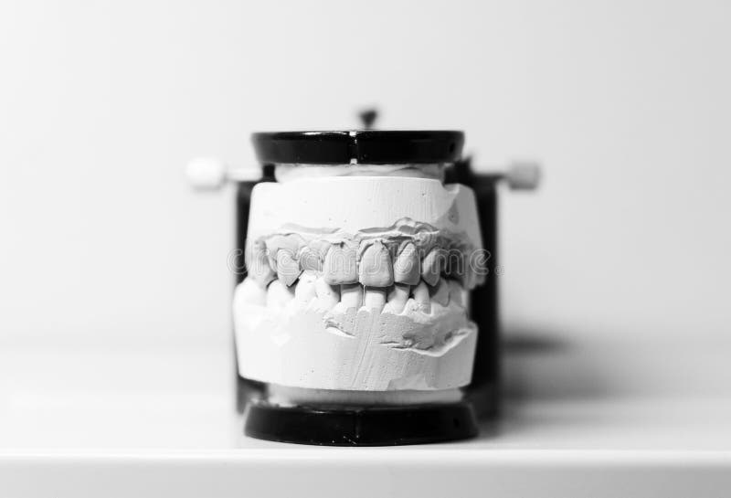 Orthodontic Prosthesis. Laboratory. Closeup. Dental Black and White