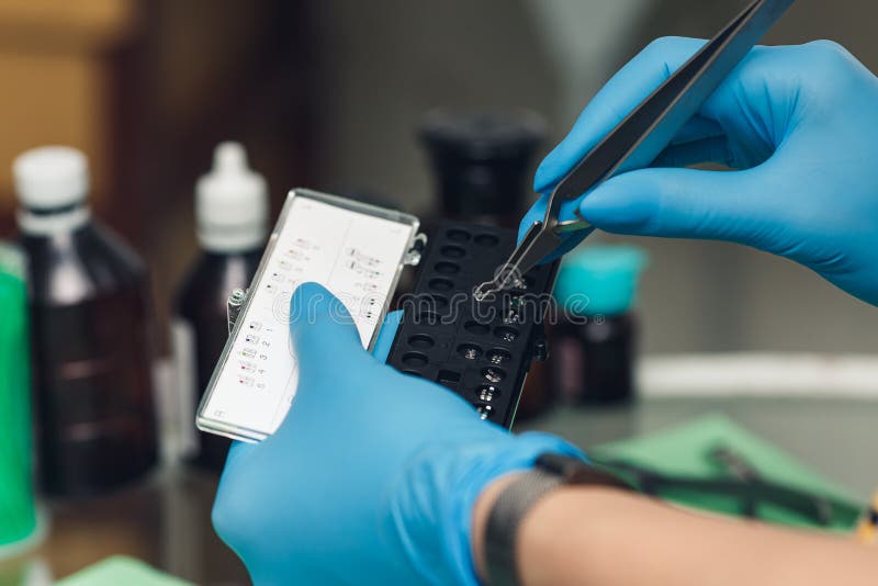 The Orthodontist Takes the Button for Braces with Forceps. Stock Image
