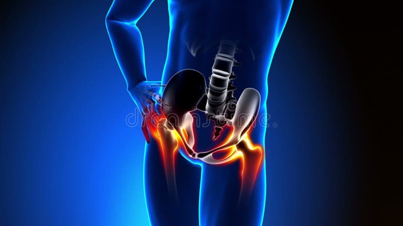 Os de la hanche - Douleur à l'os de la hanche - Os de la hanche douloureux illustration stock
