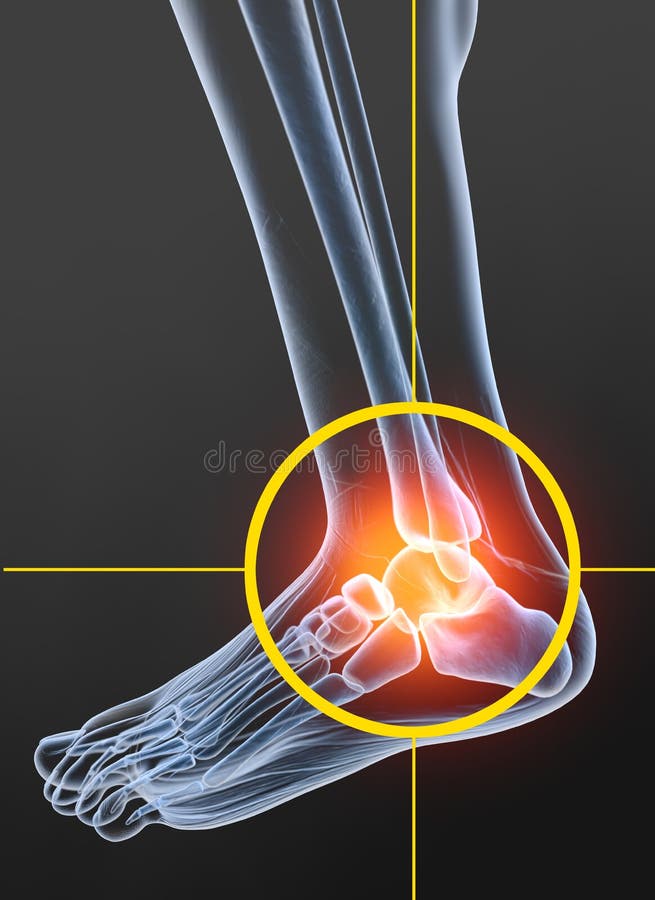 Kinésithérapie Physique Avec électrodes à Dizaines De Plaquettes De Soutien  Stimulation électrique Transcutanée Du Nerf Image stock - Image du  réhabilitation, matériel: 210758631