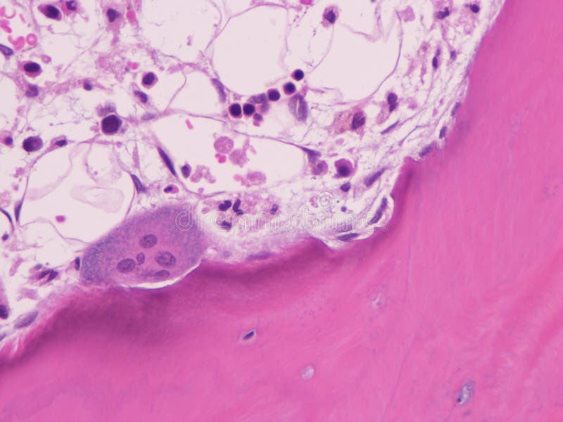 Osteoclast. stock photo. Image of cytology, osteoclasts 278413378
