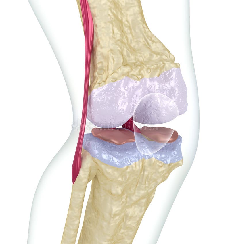 Osteoporosis de la junta de rodilla Aislado en blanco
